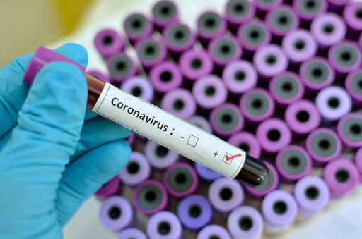 Coronavirus. Cgil, Cisl e Uil chiedono incontro al governatore Santelli